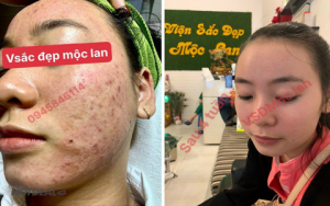 Mộc Lan Đường ở đâu? Địa chỉ uy tín cho sản phẩm làm đẹp.